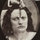 Image for article titled Terrifying, Century-Old Photographs from Neuroscience Experiments